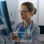 أورام العظام