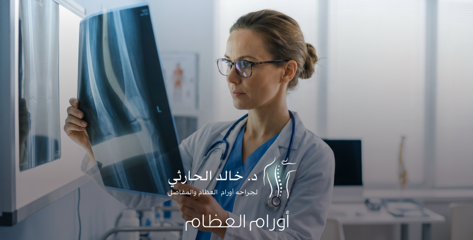 أورام العظام