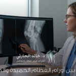 الفرق بين أورام العظام الحميدة والخبيثة