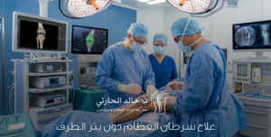 علاج أورام العظام دون بتر الطرف