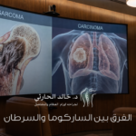 الفرق بين الساركوما والسرطان